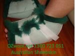 ozwool-high-temperature-washable-medical-heel-guards-1-scaled-1.jpg