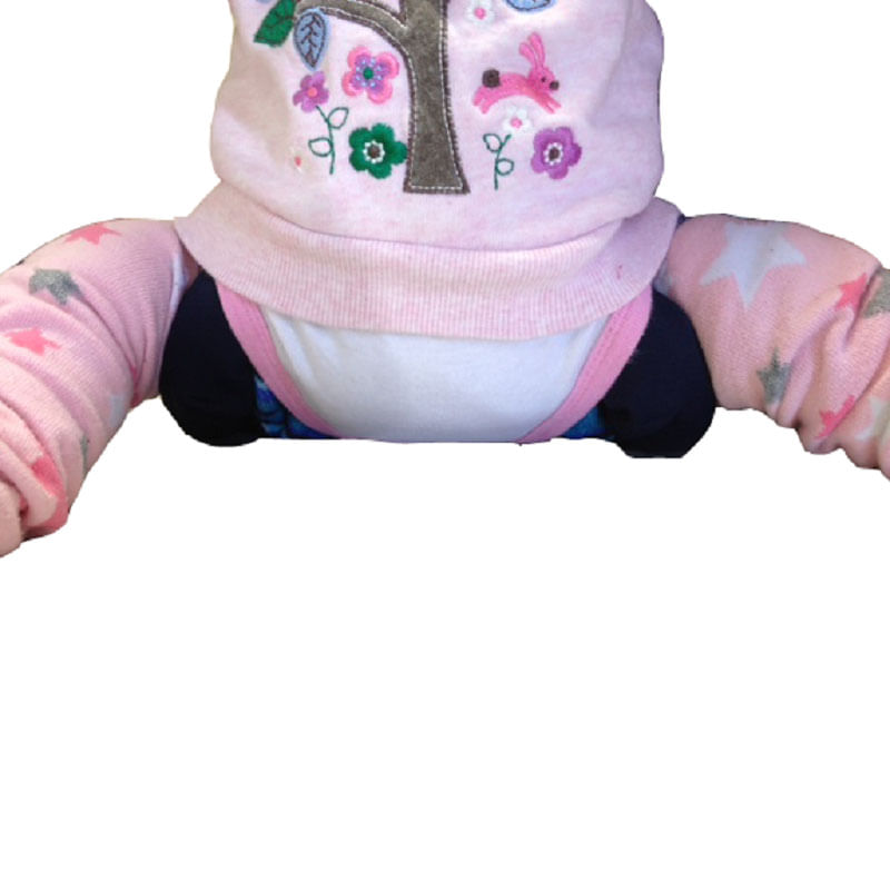 2-hip-dysplasia-brace-sleeve.jpg
