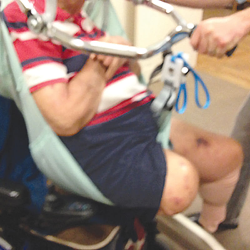 rph-double-amputee_2481.jpg